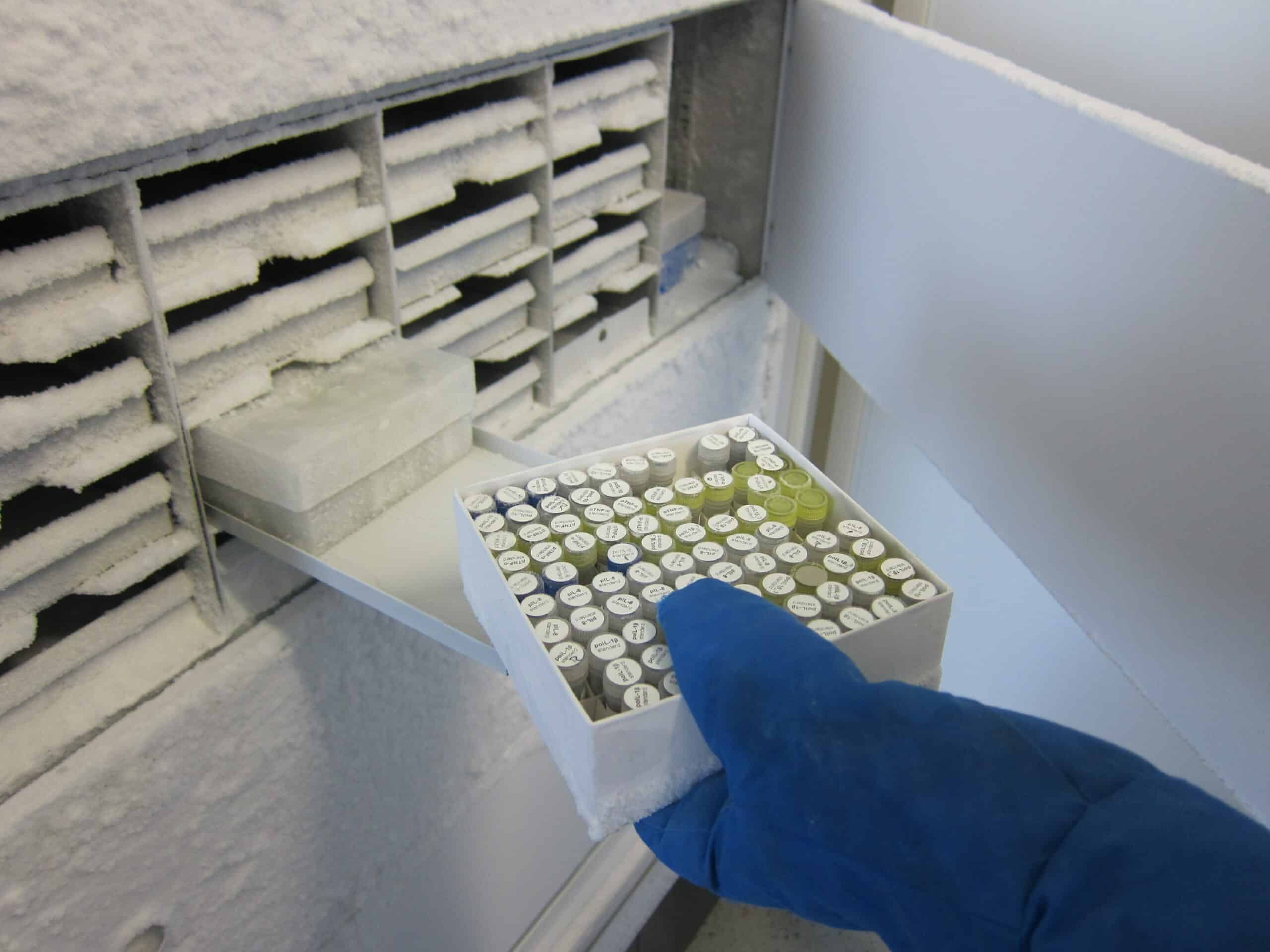 laboratory freezer for secure sample storage laboratory freezer for secure sample storage